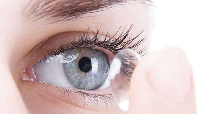 La méthode optique de correction de la vue consiste à porter des lentilles de contact. 