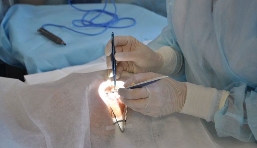 Chirurgie oculaire pour restaurer la vision